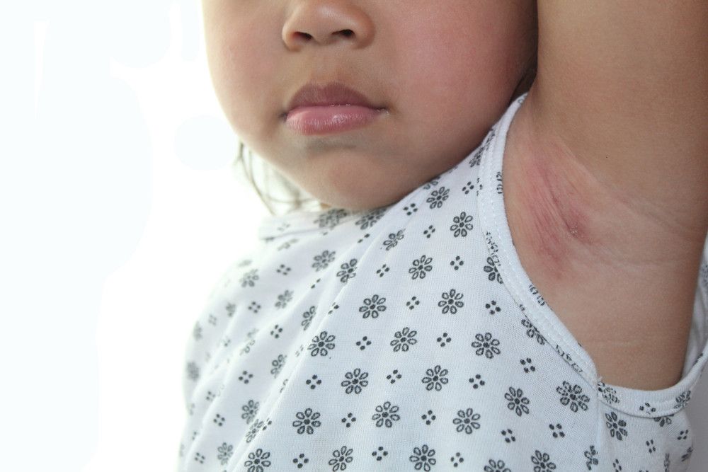 Si Kecil Bau Badan, Apa Penyebabnya?