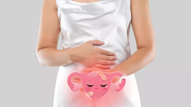 Benarkah Risiko Endometriosis Meningkat Akibat Kekurangan Vitamin D?