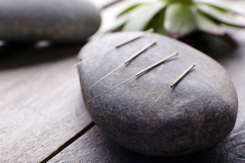 Mengatasi Sakit Kepala dengan Akupunktur