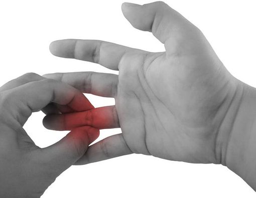 Jari Kaku dan Nyeri Sendi? Awas, Serangan Artritis Reumatoid