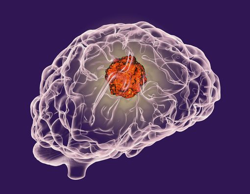 Glioblastoma, Kanker Otak yang Merenggut Nyawa John McCain