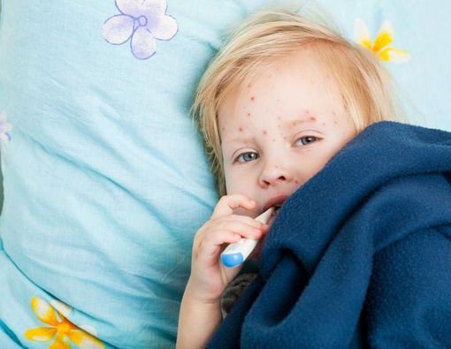 Kulit Anak Merah-Merah, Apakah Karena Alergi?