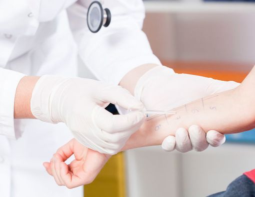 Perlukah Tes Alergi Sejak Dini pada Anak?