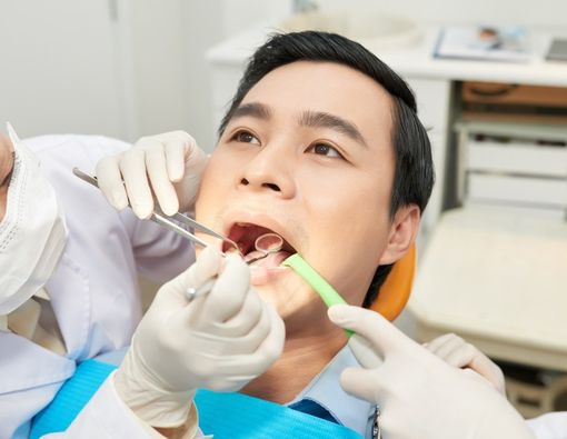 7 Cara Ampuh Atasi Gigi Depan Berlubang yang Ganggu Penampilan