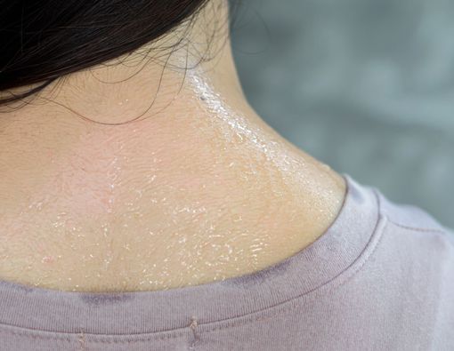 Keringat Berlebih, Ini Penyebab yang Perlu Kamu Waspadai