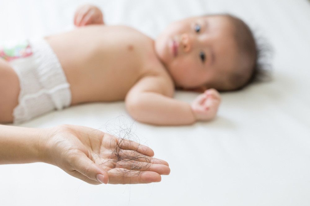 Rambut Anak Sering Rontok, Pertanda Apa? (Comzeal Images/Shutterstock)
