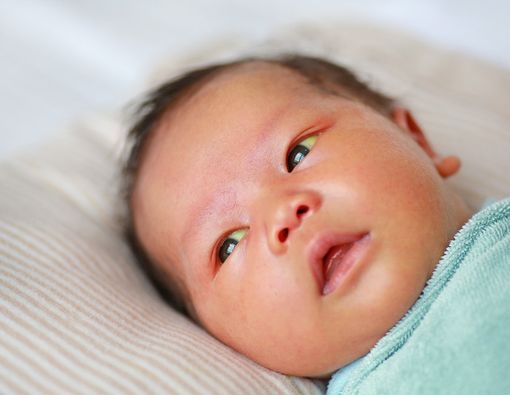 Bayi Kuning Hari Pertama Kelahiran Penyebab Kejang pada Anak