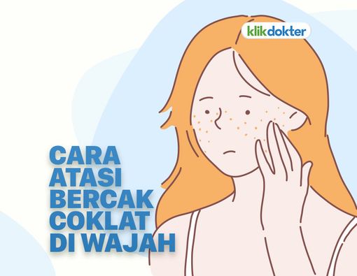 Hilangkan Bercak Cokelat di Wajah dengan Cara Ini