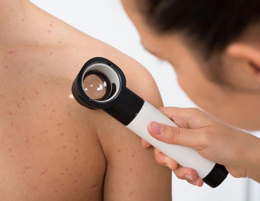 7 Penyakit Ini Bisa Dideteksi Lewat Kulit Anda