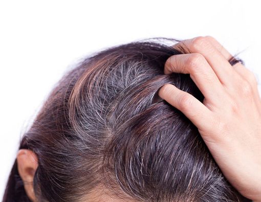 Inilah 4 Penyebab Uban di Usia 20-an