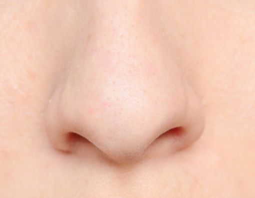 7 Penyakit yang Bisa Dideteksi Lewat Bau