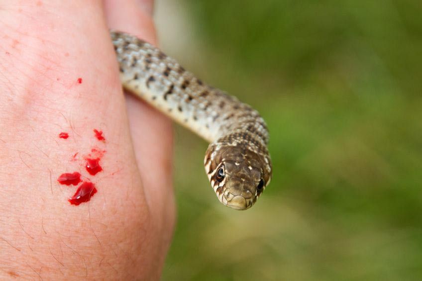 Kenali Bahaya Dan Pertolongan Pertama Pada Luka Gigit - vrogue.co