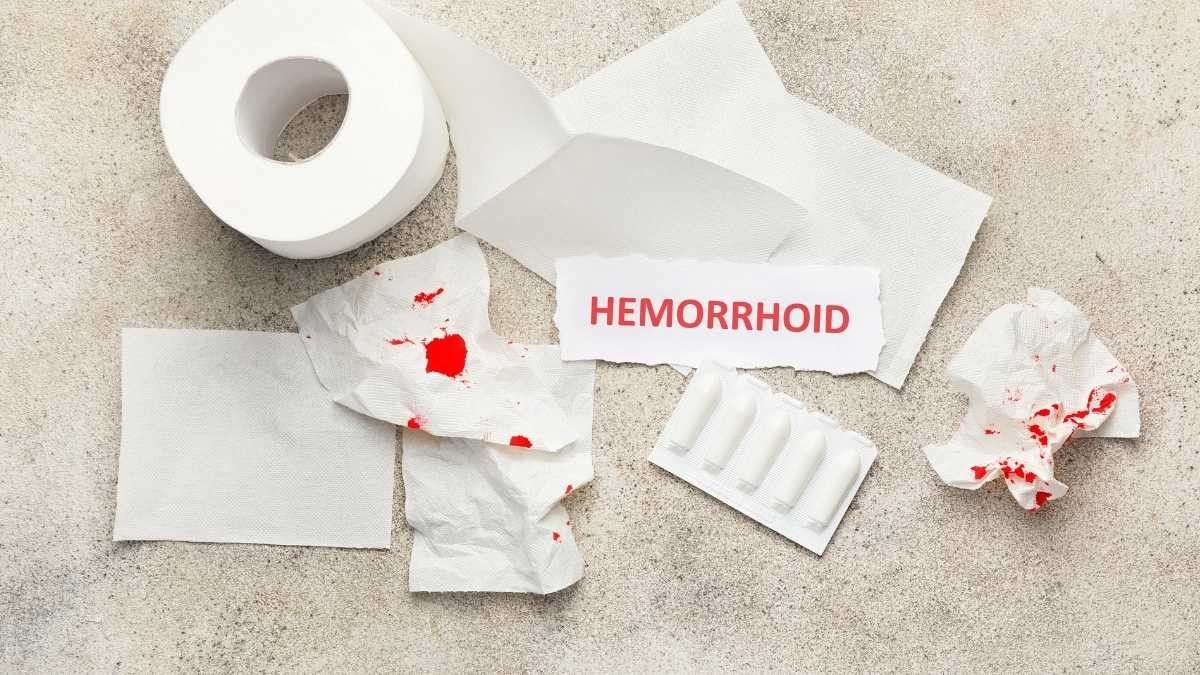 Penyebab dan Cara Mengatasi Ambeien Setelah Melahirkan