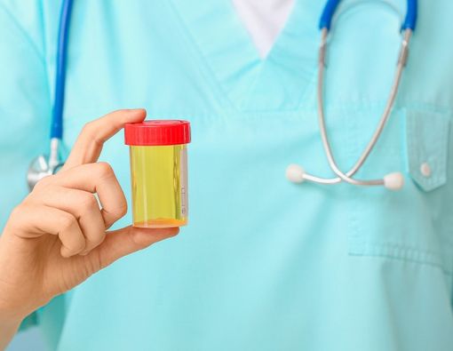 Urine Berbau Manis Tanda Diabetes dan Ketoasidosis Diabetik