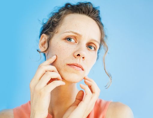 Ini yang Terjadi pada Kulit Jika Kotoran Menumpuk