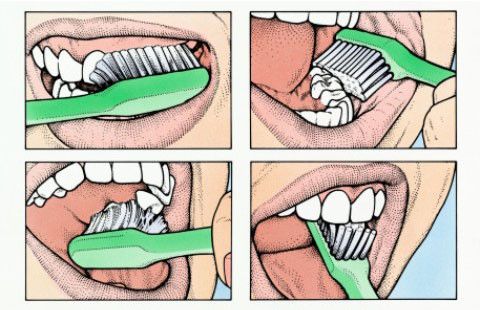 Cara Menyikat Gigi yang Benar