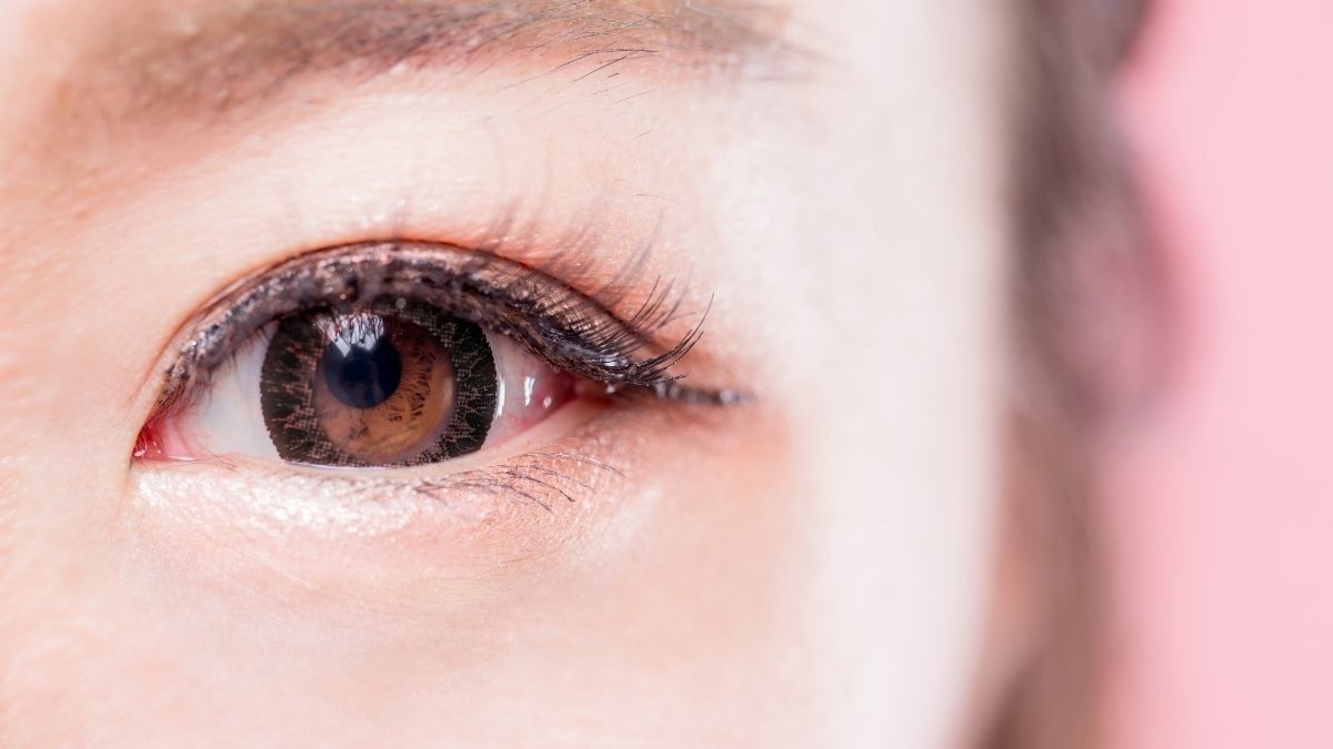 Arti Medis di Balik Warna dan Bentuk Belek Mata