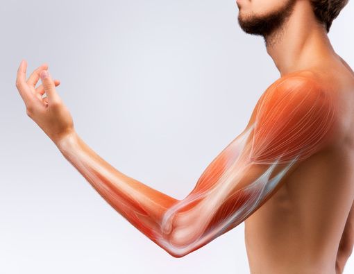 Kenali 3 Penyakit Kelemahan Otot Selain Penyakit Pompe