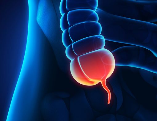 Mitos dan Fakta Tentang Usus Buntu