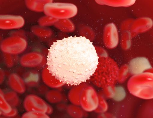 Antisipasi Leukemia dengan Mengenali Penyebabnya