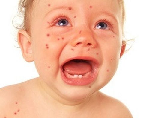 Pentingnya Pencegahan Alergi Susu Sapi Sejak Dini