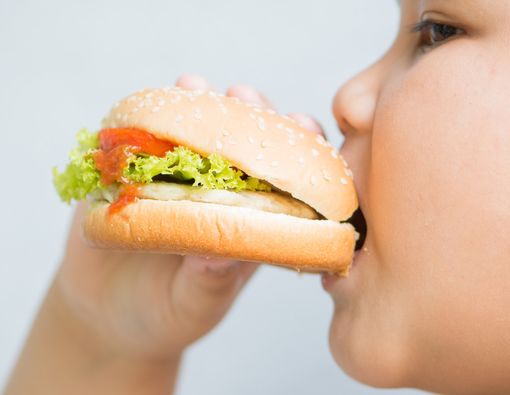 Sindrom Prader-Willi