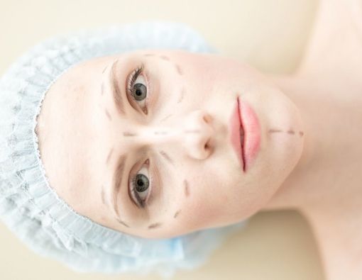 Epicanthoplasty, Operasi Plastik untuk Perbaiki Lipatan Mata