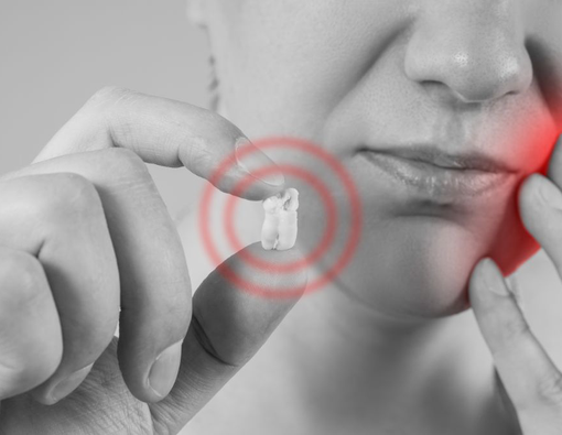 Tips Pemulihan Setelah Operasi Gigi Bungsu