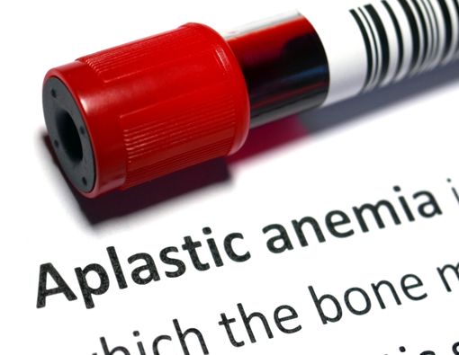 Mengapa Obat Sakit Kepala Picu Anemia Aplastik?