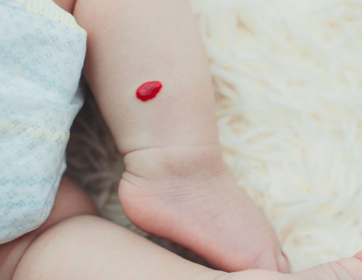 Hemangioma, Benjolan Merah pada Kulit Bayi, Berbahayakah?