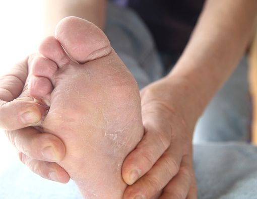 Tips Cegah Penyakit Kulit Kutu Air bagi Atlet Asian Games