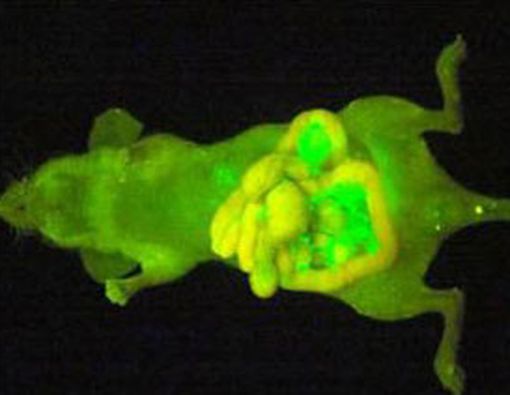 Penemuan Reagen: Sel Kanker Bercahaya &amp; Terlihat Mata