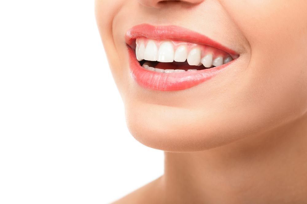 6 Fakta di Balik Mitos tentang Memutihkan Gigi