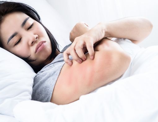 Mengapa Penyakit Kulit Lebih Sering Muncul Saat Cuaca Panas Ekstrem?