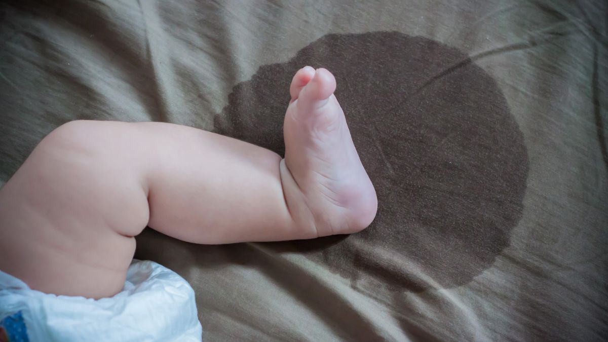Cara Mengukur Jumlah Urine Normal pada Anak dan Bayi