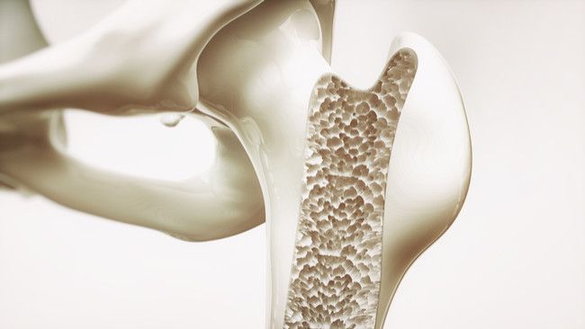 Tips Pola Hidup Sehat untuk Pencegahan Osteoporosis