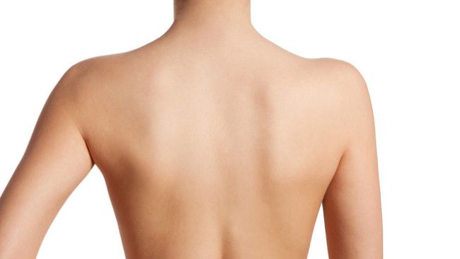 5 Alasan Mengapa Anda Sering Mengalami Nyeri Punggung