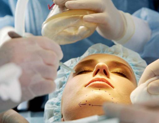 Serba-Serbi Operasi Antiaging Agar Tampil Awet Muda