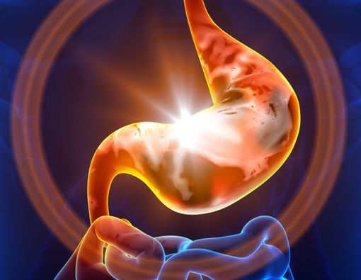 5 Pantangan Makanan untuk Penderita Sakit Lambung