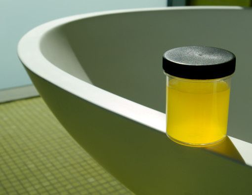 Perubahan Warna &amp; Bau Urin