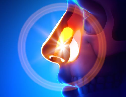 Gejala Kanker Hidung yang Perlu Anda Tahu