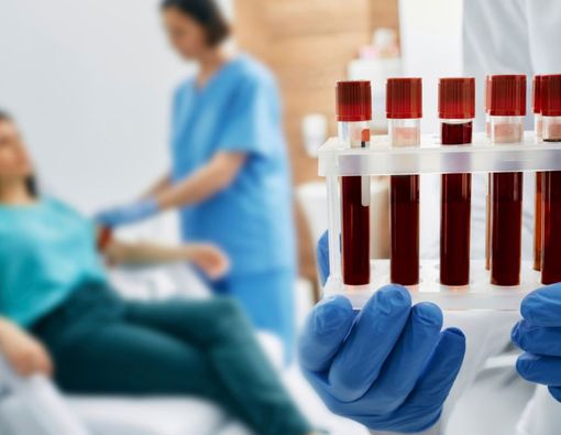 Tes Hematologi Darah Lengkap untuk Deteksi Penyakit