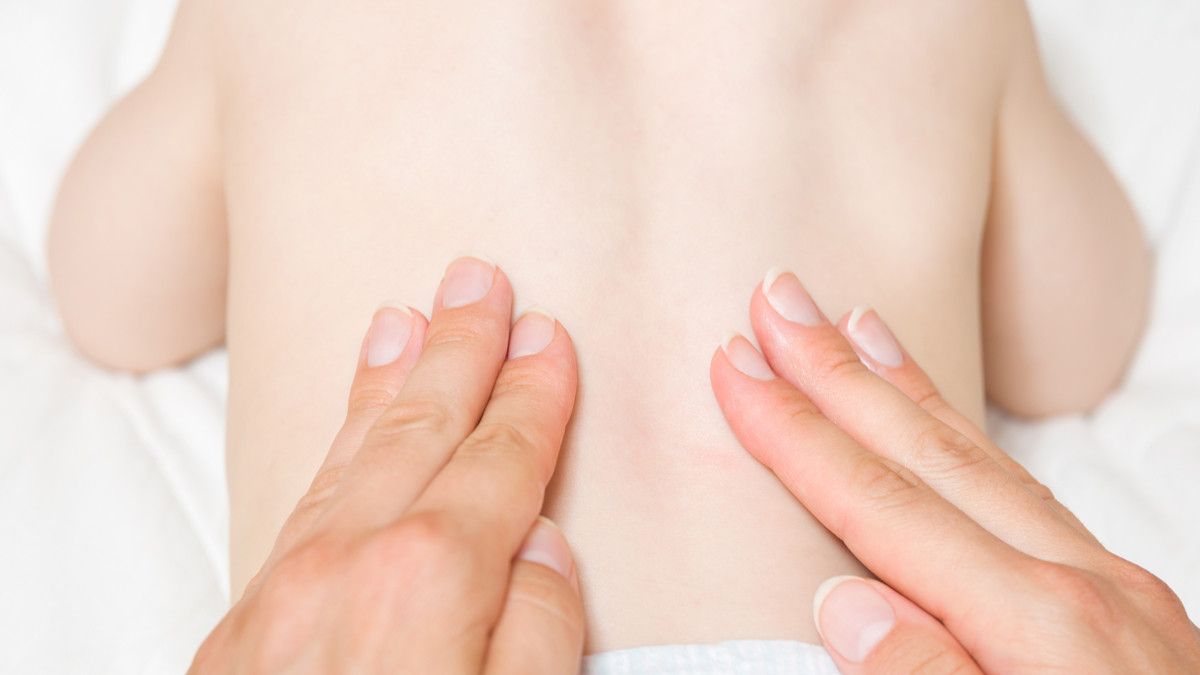 Gejala dan Pengobatan Bayi dengan Skoliosis