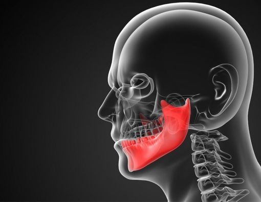 Gejala Kanker Tulang Rahang yang Harus Diwaspadai