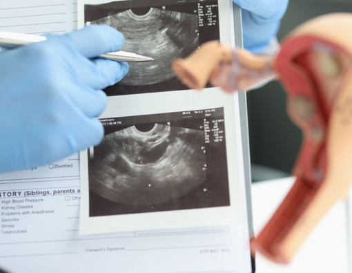 Air Ketuban Sedikit Selama Hamil? Ini Penyebab dan Cara Mengatasinya