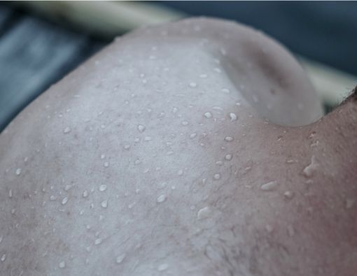 Punya Masalah dengan Keringat Berlebih? Ini Cara Mengatasinya