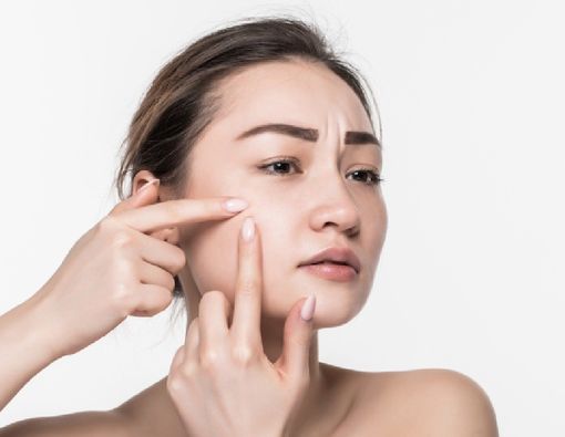 Benarkah Jerawat Bisa Menular? Ini Fakta Medisnya