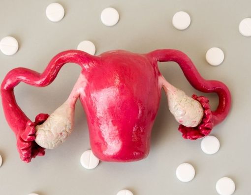 10 Cara Mengobati Tuba Falopi Tersumbat Secara Alami