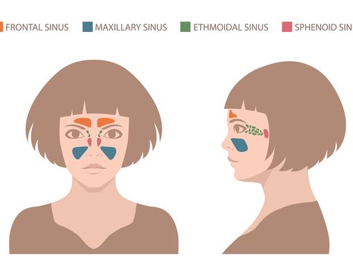 Mitos vs Fakta Sinusitis yang Perlu Anda Tahu