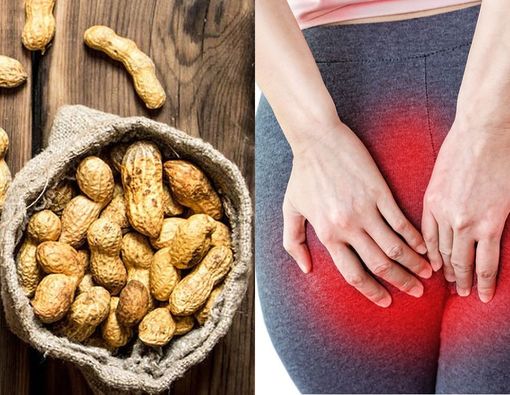 Hindari Makanan Ini Agar Tak Sering Kentut